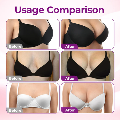 💥Slimoly®📛Targeted Breast Enhancement Advanced Nano Microneedle Patch🥯